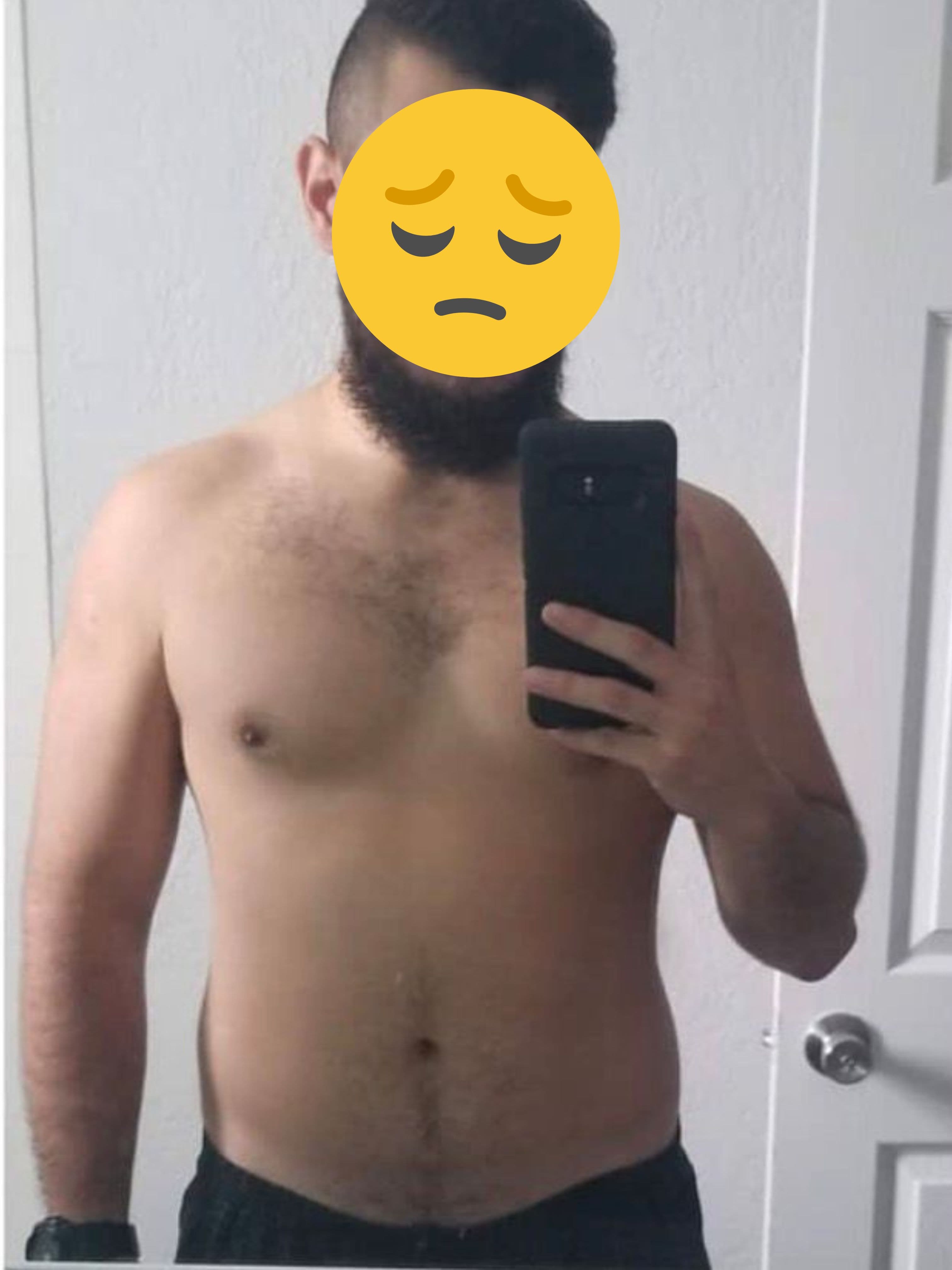 Before — Orlando C.